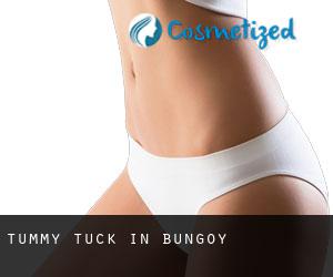 Tummy Tuck in Bungoy