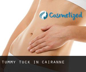 Tummy Tuck in Cairanne
