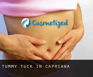 Tummy Tuck in Capriana