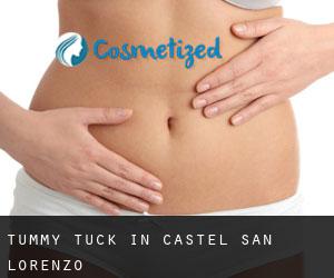 Tummy Tuck in Castel San Lorenzo