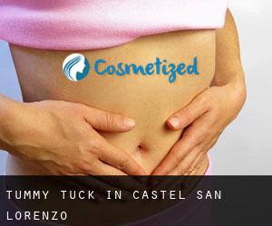 Tummy Tuck in Castel San Lorenzo