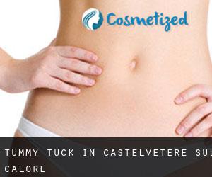 Tummy Tuck in Castelvetere sul Calore