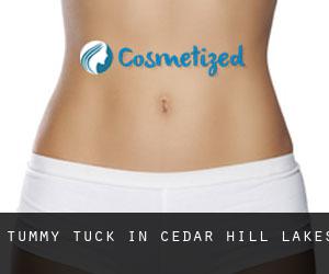 Tummy Tuck in Cedar Hill Lakes