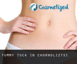 Tummy Tuck in Chornoliztsi