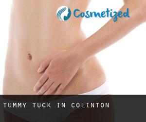 Tummy Tuck in Colinton