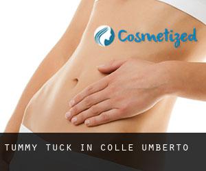 Tummy Tuck in Colle Umberto