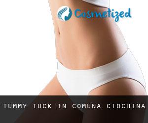 Tummy Tuck in Comuna Ciochina