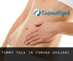 Tummy Tuck in Comuna Găujani