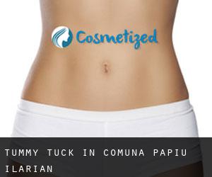 Tummy Tuck in Comuna Papiu Ilarian