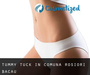 Tummy Tuck in Comuna Roşiori (Bacău)