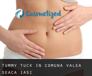 Tummy Tuck in Comuna Valea Seacă (Iaşi)