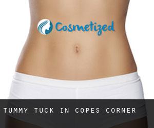 Tummy Tuck in Copes Corner