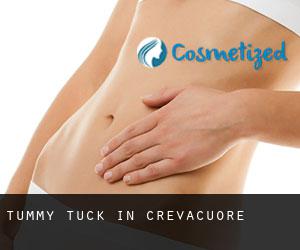 Tummy Tuck in Crevacuore