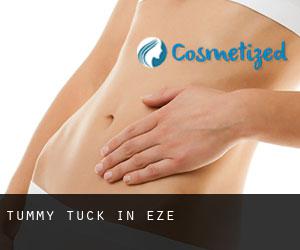 Tummy Tuck in Èze