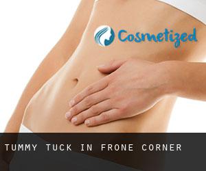 Tummy Tuck in Frone Corner