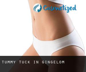 Tummy Tuck in Gingelom