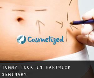 Tummy Tuck in Hartwick Seminary