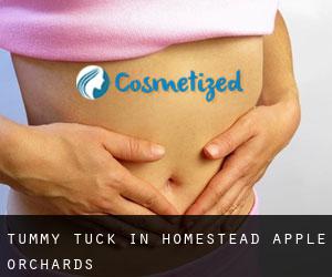 Tummy Tuck in Homestead Apple Orchards