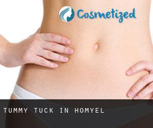 Tummy Tuck in Homyel