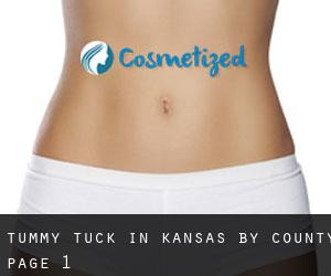Tummy Tuck in Kansas by County - page 1
