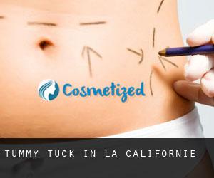 Tummy Tuck in La Californie