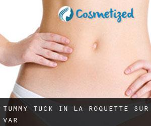 Tummy Tuck in La Roquette-sur-Var