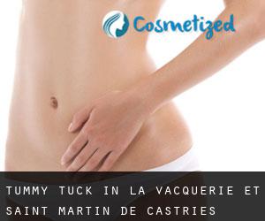 Tummy Tuck in La Vacquerie-et-Saint-Martin-de-Castries