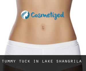 Tummy Tuck in Lake Shangrila