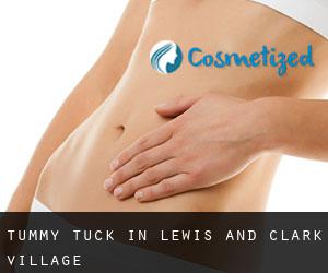 Tummy Tuck in Lewis and Clark Village