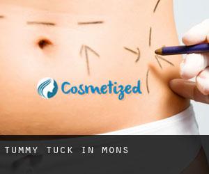 Tummy Tuck in Mons