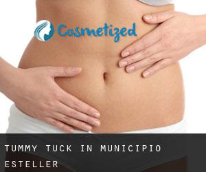 Tummy Tuck in Municipio Esteller