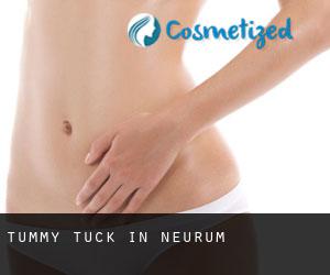 Tummy Tuck in Neurum