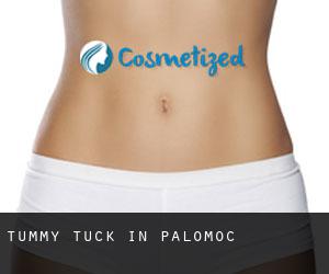 Tummy Tuck in Palomoc
