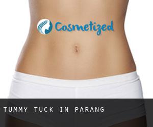 Tummy Tuck in Parang