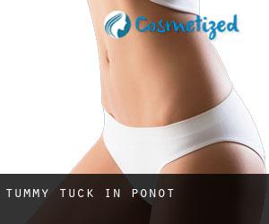 Tummy Tuck in Ponot