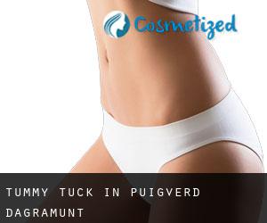 Tummy Tuck in Puigverd d'Agramunt