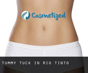 Tummy Tuck in Rio Tinto