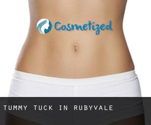 Tummy Tuck in Rubyvale