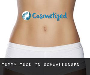 Tummy Tuck in Schwallungen