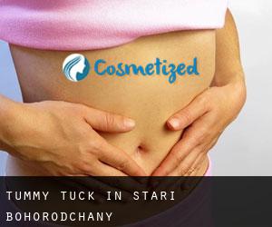 Tummy Tuck in Stari Bohorodchany