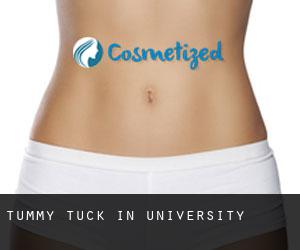 Tummy Tuck in University
