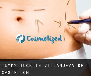 Tummy Tuck in Villanueva de Castellón