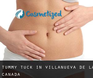 Tummy Tuck in Villanueva de la Cañada