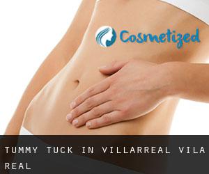 Tummy Tuck in Villarreal / Vila-real