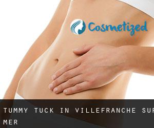 Tummy Tuck in Villefranche-sur-Mer