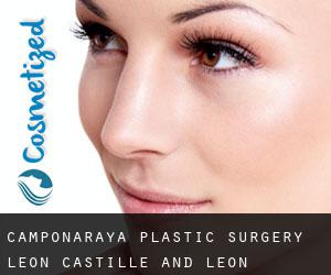 Camponaraya plastic surgery (Leon, Castille and León)