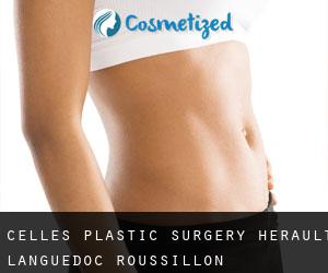 Celles plastic surgery (Hérault, Languedoc-Roussillon)