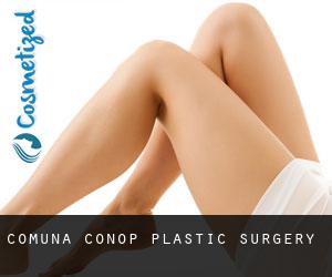Comuna Conop plastic surgery