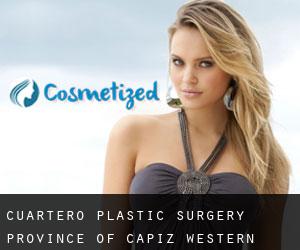 Cuartero plastic surgery (Province of Capiz, Western Visayas)
