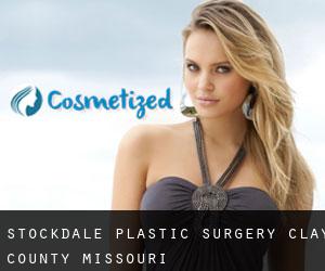 Stockdale plastic surgery (Clay County, Missouri)